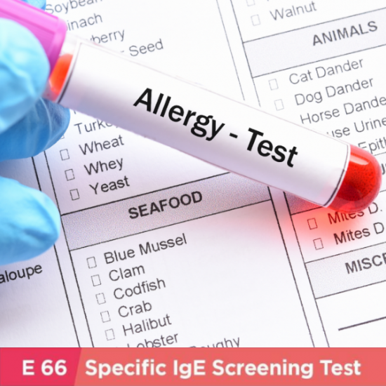 allergy-ige-test-e66-items